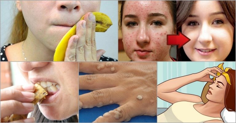 Jokiais būdais neišmeskite bananų žievių! Štai 10 būdų kaip jas panaudoti