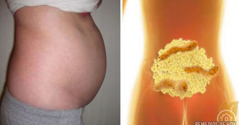 Išsivaliau žarnyną ir netekau 11 kg per mėnesį – SUPER žarnyno valymas!