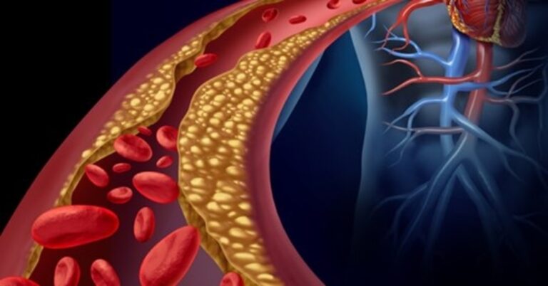 Kaip sumažinti cholesterolio kiekį ir pagerinti kepenų bei širdies veiklą? Sužinokite!