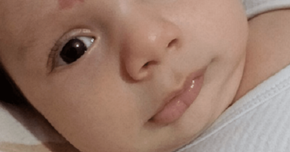 Kai gimė šis kūdikis, akušerė buvo be žodžių. Viskas dėl vieno apgamo