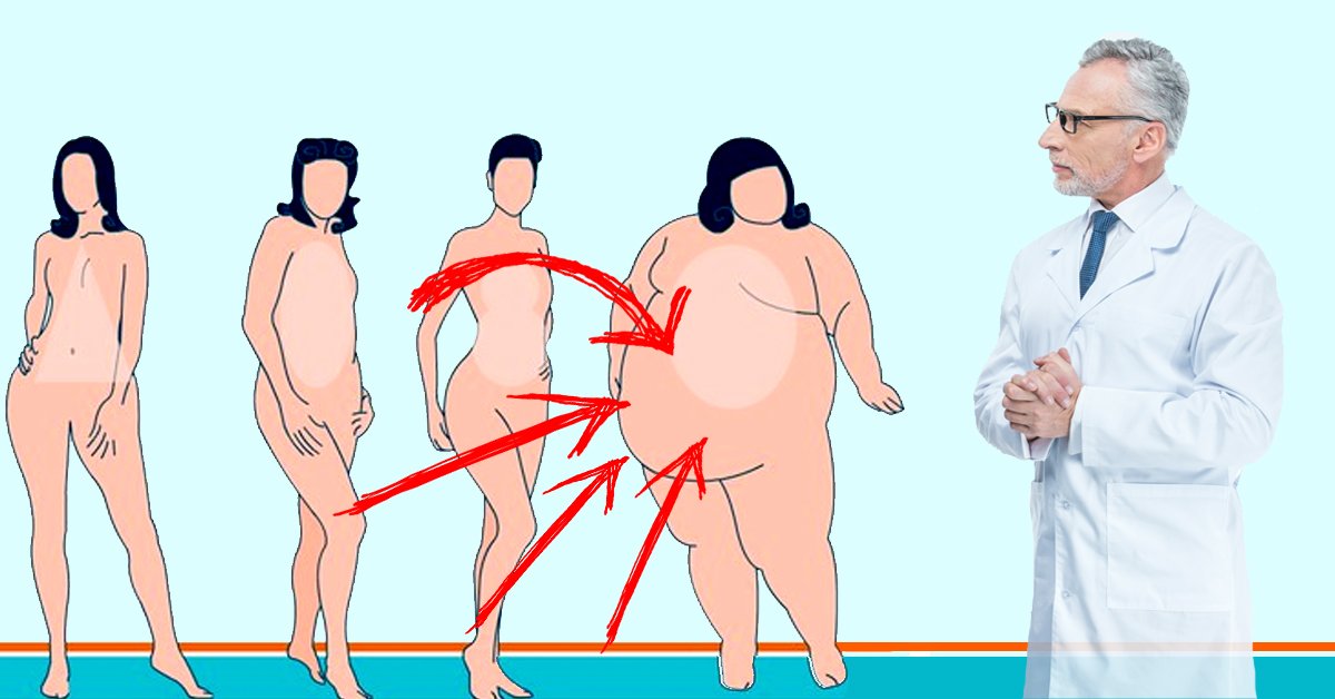 Praverčia ne tik dietos! Patarimai, kaip namuose numesti svorio