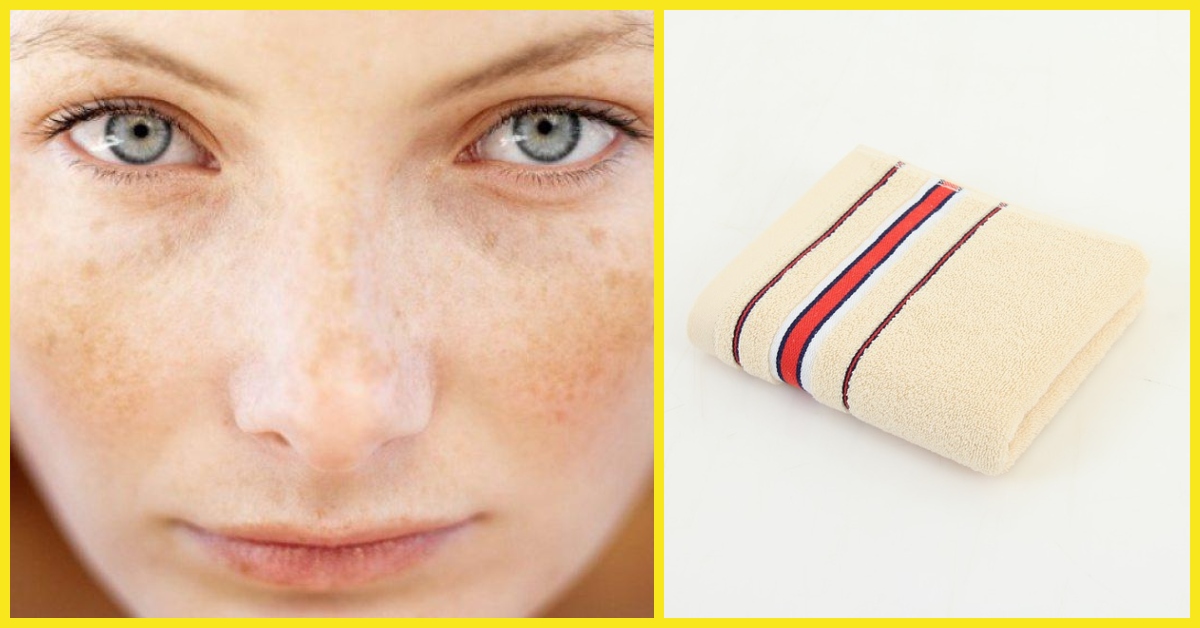 Nusiprausus veidą, jo valymas rankšluosčiu labai neigiamai veikia odą