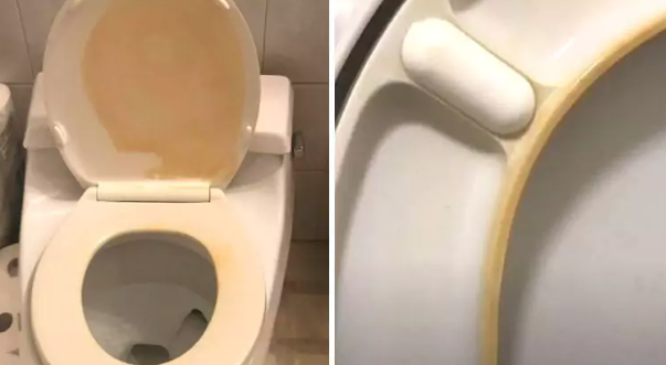 Kaip pašalinti geltonas dėmes nuo unitazo dangčio?