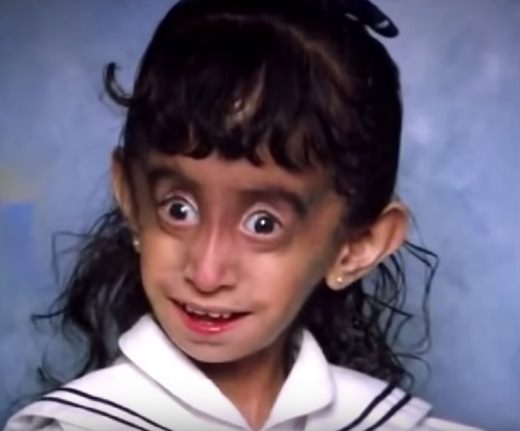 Istorija apie ypatingąją Lizzie Velásquez: pasidomėkime, kaip jai sekasi šiandien