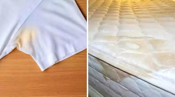 14 sunkiai įveikiamų dėmių ir patarimai, kurie padės su jomis kovoti