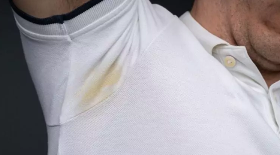 Kaip atsikratyti ant drabužių atsiradusių geltonų dėmių be šveitimo ir cheminių baliklių?