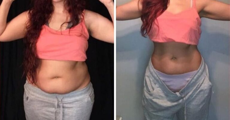 Kaip atsikratyti suglebusio pilvo be alinančių dietų ir intensyvių treniruočių?