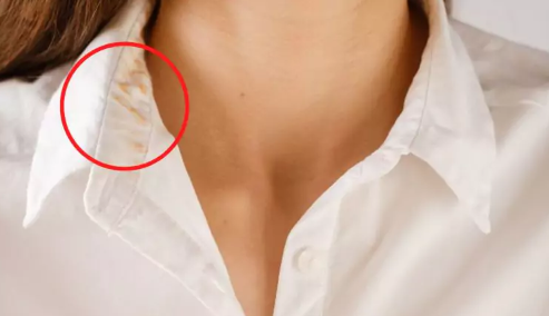 Kaip pašalinti ant drabužių atsiradusias pudros dėmes?
