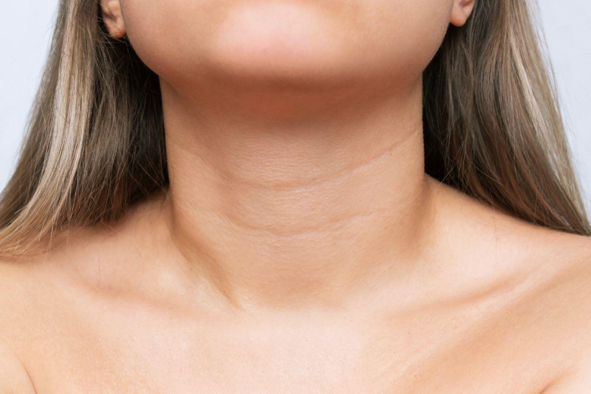 Veneros karoliai: kaip juos atpažinti ir veiksmingai pašalinti?