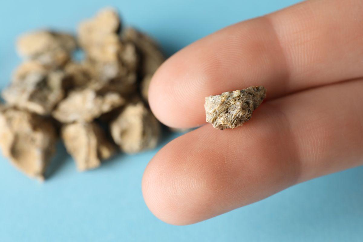 Šis gėrimas išgelbės jūsų nuo inkstų akmenų: svarbūs patarimai