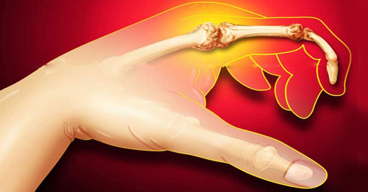 Maisto produktai, kurie padidina šlapimo rūgšties kiekį organizme