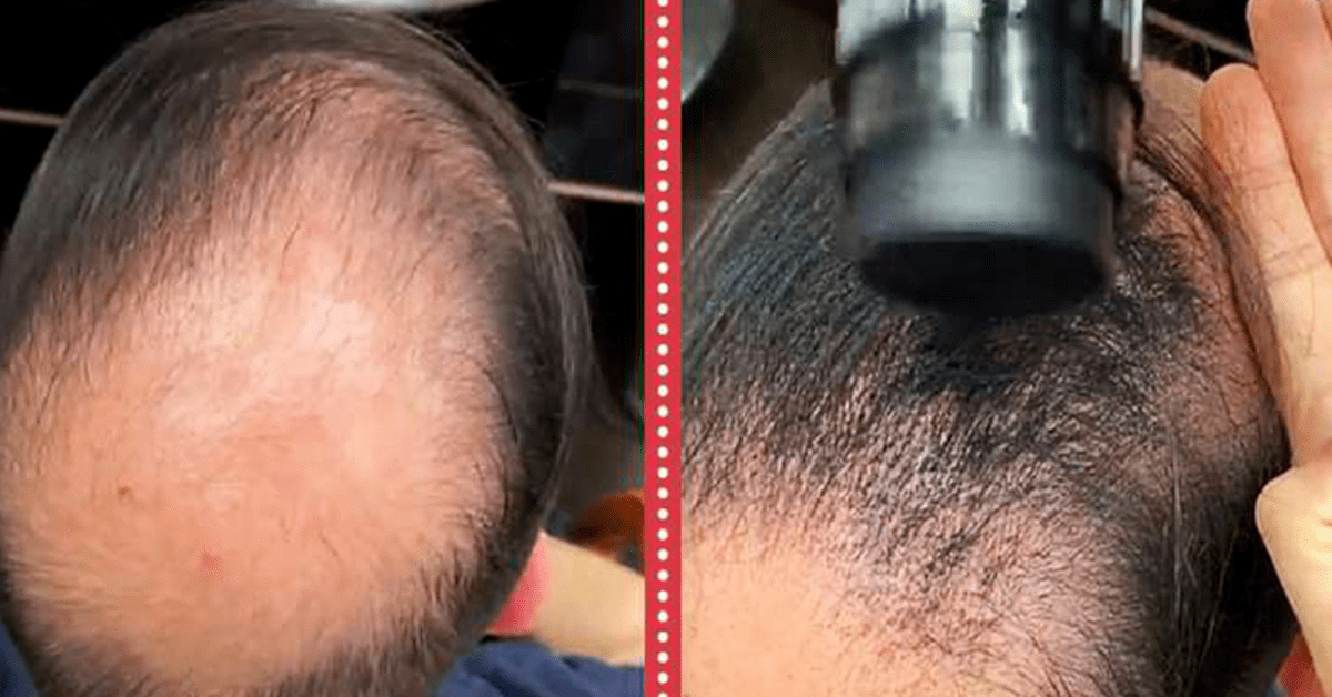 Kirpėjas vyrui padarė nuostabią šukuoseną. Mylimoji jo neatpažino