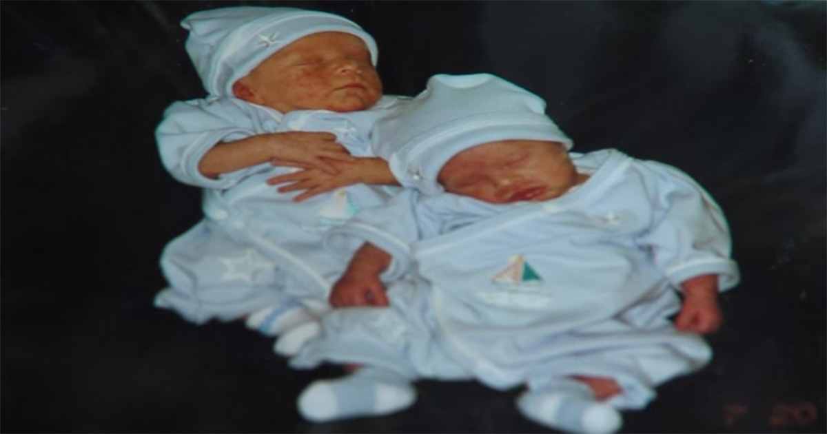 Šie dvyniai gimė skirtingi, o tai, ką vienas iš jų padarė užaugęs, sujaudino visus!