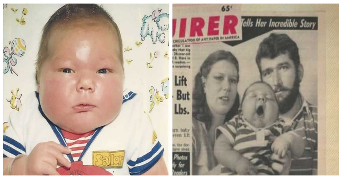 1983 m. gimė kūdikis, sveriantis 7,2 kg. Kaip jis gyvena po 36 metų?
