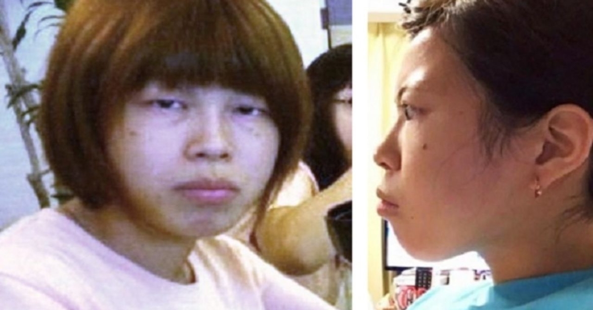 Mergina už grožio operacijas sumokėjo daugiau nei 54 tūkst. eurų. Ar buvo verta?