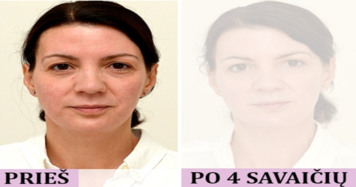 Kas nutiks jūsų išvaizdai, jei per dieną išgersite 8 stiklines vandens?