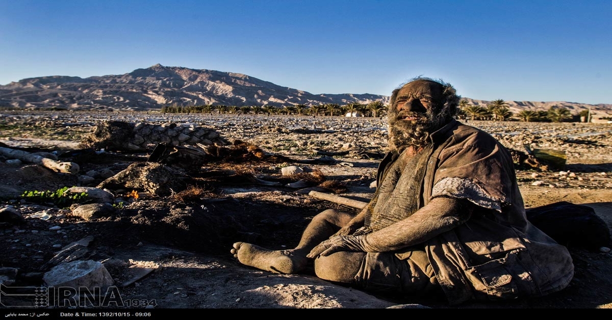 Pažiūrėkite, kaip atrodo vyras, kuris nesiprausė 60 metų