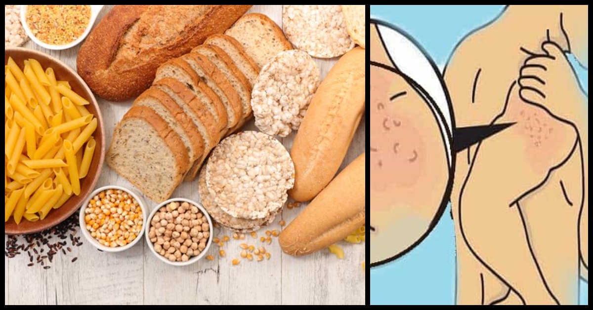 Glitimo netoleravimas: požymiai, kurių geriau neignoruoti