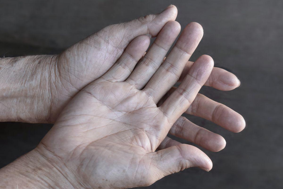 Geležies trūkumas organizme: 13 simptomų, kurių negalima ignoruoti