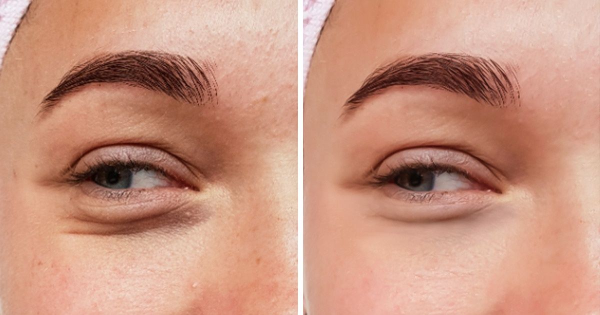 5 simptomai, kurie rodo, kad organizmui trūksta fizinio aktyvumo