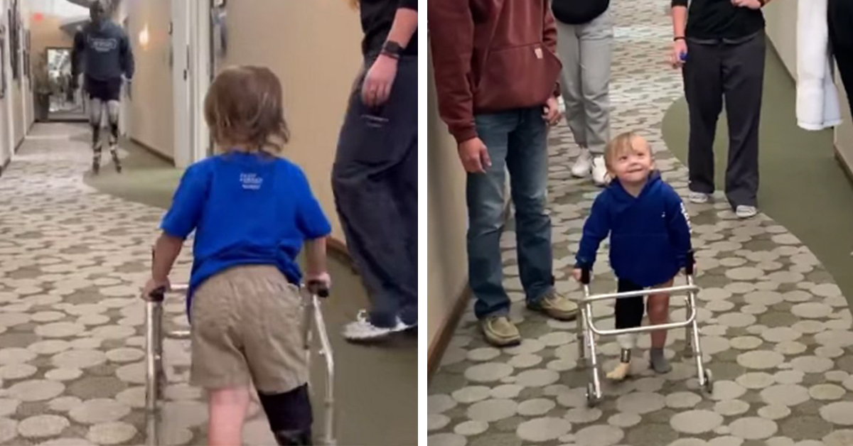 Dvimetis neteko kojos... Tačiau gavus protezą sulaukė netikėto palaikymo