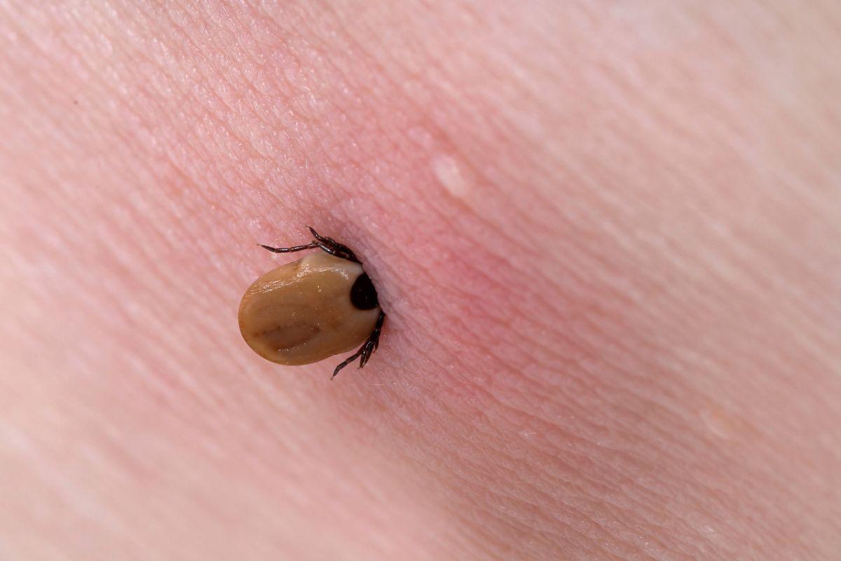 Kaip saugiai ištraukti erkę: paprasta priemonė net ir gamtoje be pinceto