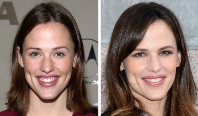 15 žvaigždžių, įrodančių, kad nauja šypsena gali visiškai pakeisti mūsų išvaizdą